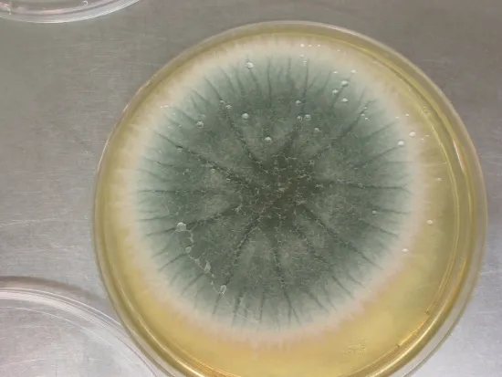 Aspergillus and Health Risks - A Petri Dish with Aspergillus Mold Growing in it